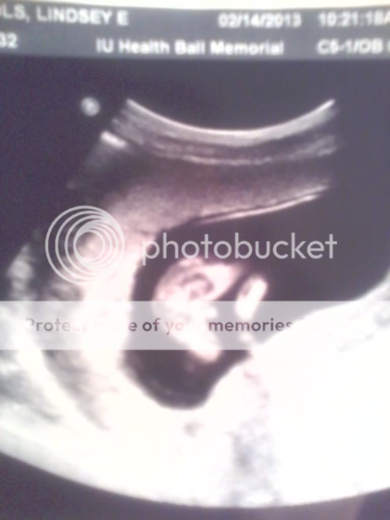 Boy or girl? Let's see those ultrasound "potty shots!" BabyCenter